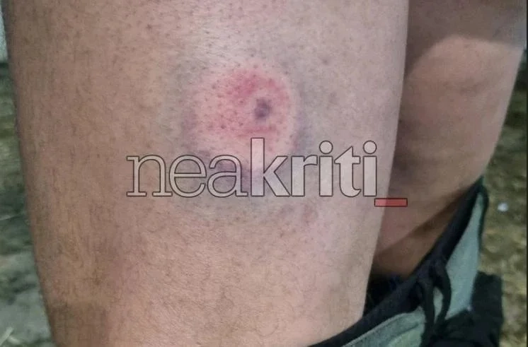Κρήτη: Διαψεύδει η ΕΛΑΣ τη χρήση πλαστικών σφαιρών κατά τη διάρκεια των αγροτικών κινητοποιήσεων Κρήτη: Διαψεύδει η ΕΛΑΣ τη χρήση πλαστικών σφαιρών κατά τη διάρκεια των αγροτικών κινητοποιήσεων