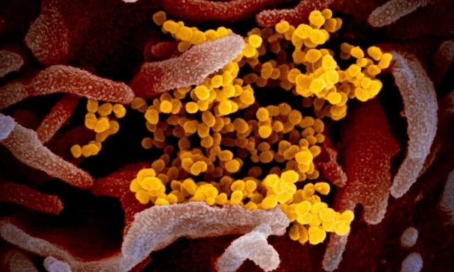 Ιός Nipah: Πώς τον αξιολογεί ο ΠΟΥ μετά τα κρούσματα σε Ινδία και Μπαγκλαντές Πρώτος θάνατος εξαιτίας του ιού Nipah στο Μπαγκλαντές - Μεγάλη ανησυχία μετά τα κρούσματα στην Ινδία